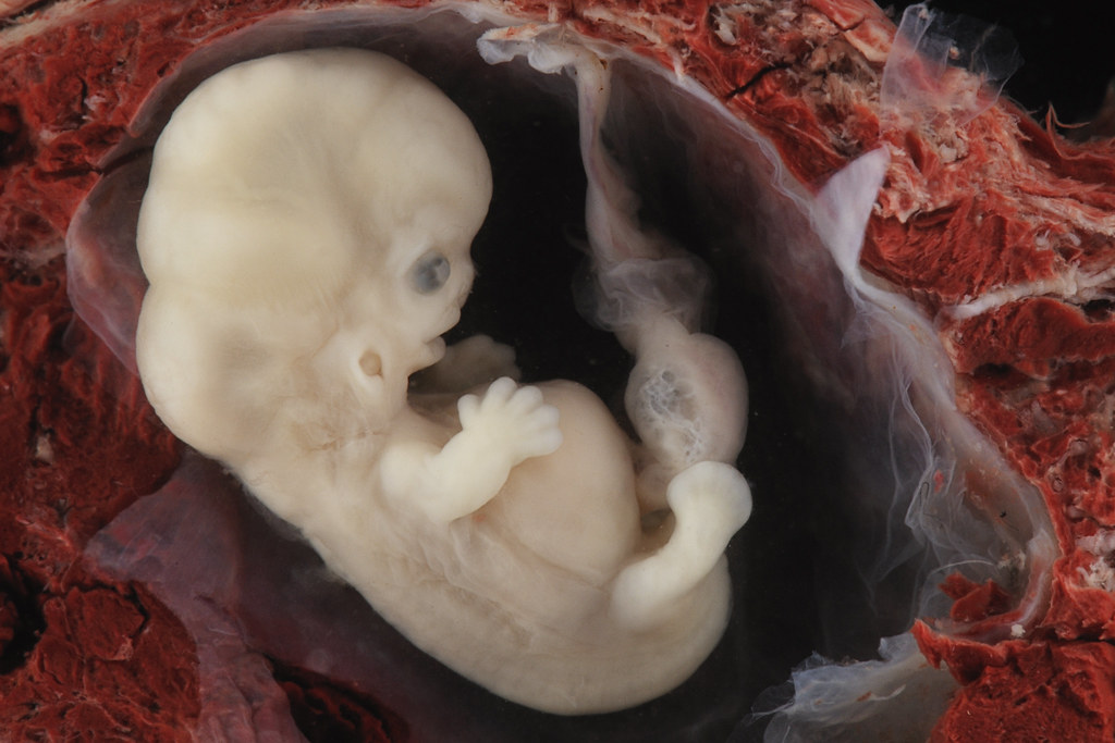 Incredible Real Photos of the Human Developing in the Womb