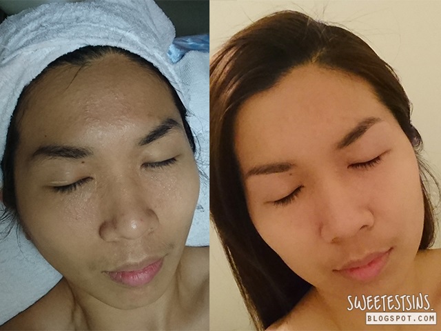 before and after indulgence aqua spiral therapy facial