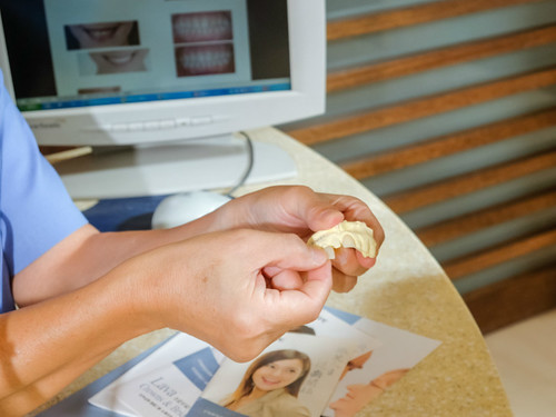 [推薦] 台南佳美牙醫陶瓷美白貼片拯救了天生牙齒黃的我 (9)