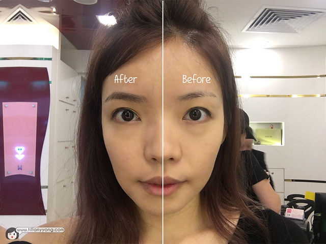 Allure Beauty Eyebrow Embroidery Before After